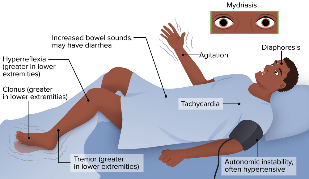 Seretonin Syndrome